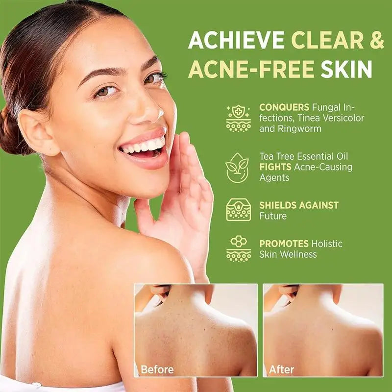 Gentle For Sensitive Skin Plant-Based Care Moisturizing for Body Skin Cleaning,Gentle Exfoliating Bar Soap 1/3/5PCS